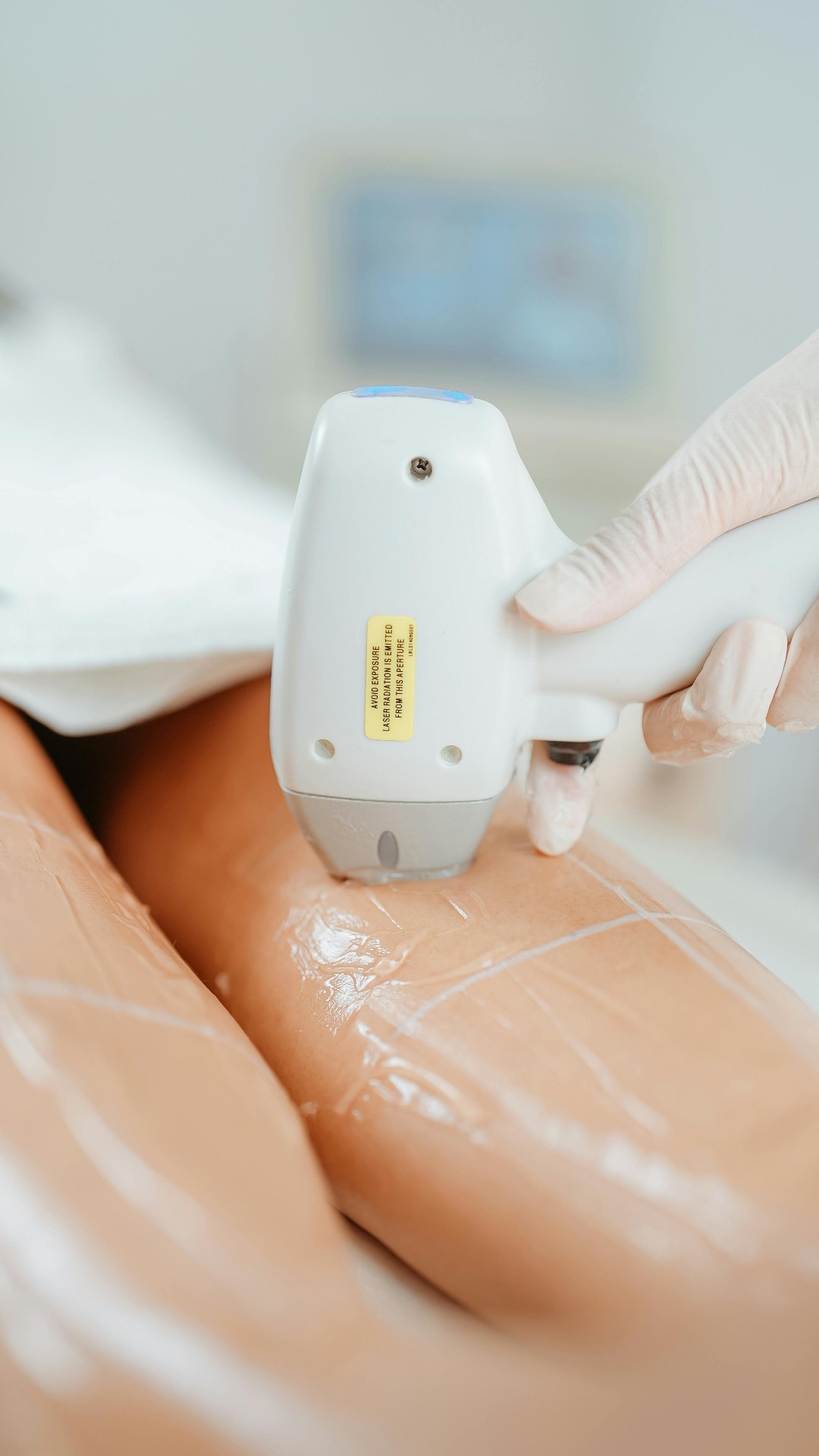 Por que sua clínica de estética perde cliente após o primeiro procedimento (e como reverter isso)